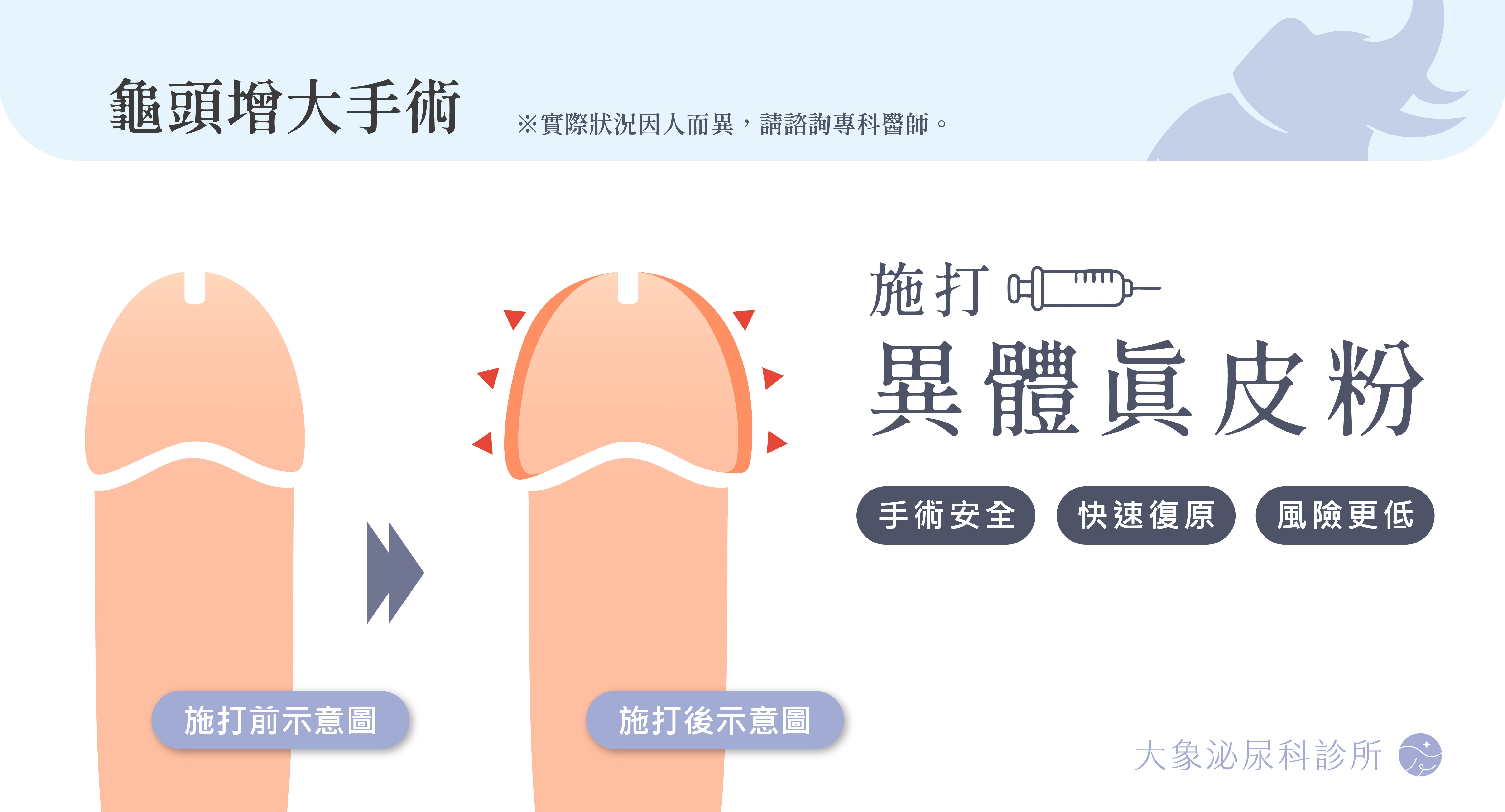 龜頭增大