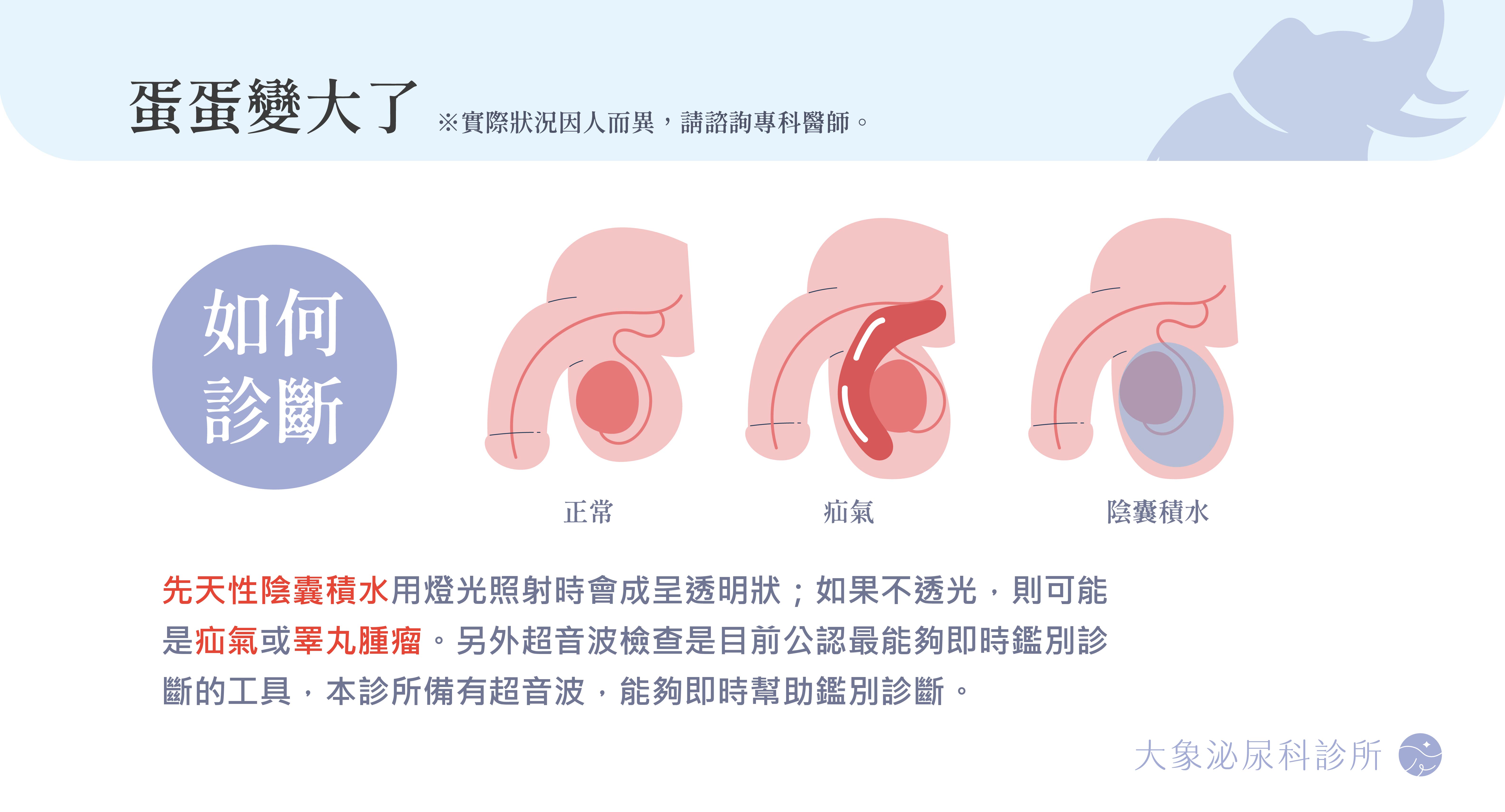 陰囊水腫