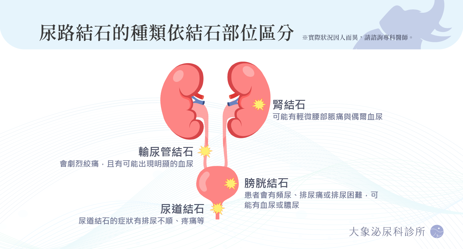 結石問題